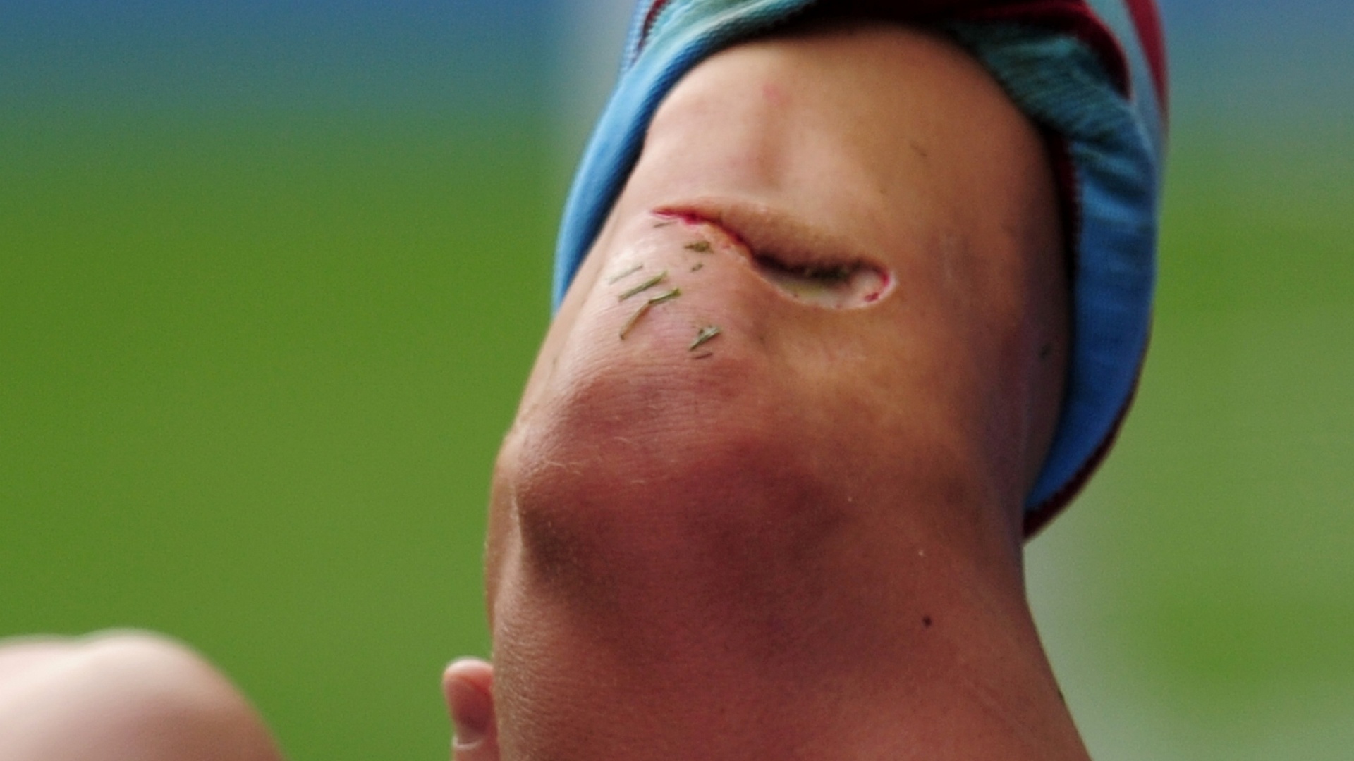 Jogador do Níger quebra a perna na Copa Africana de Nações e volta para