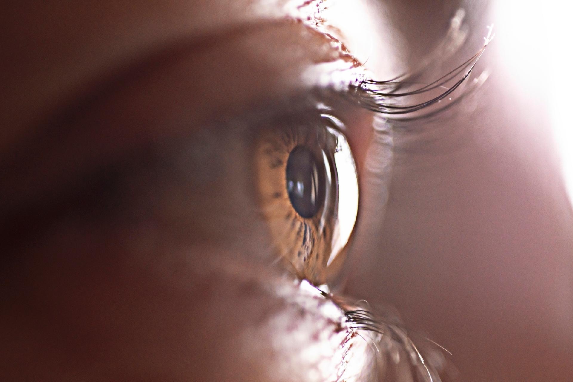 Pacientes com queixas oculares em tempos de Covid-19 - PEBMED