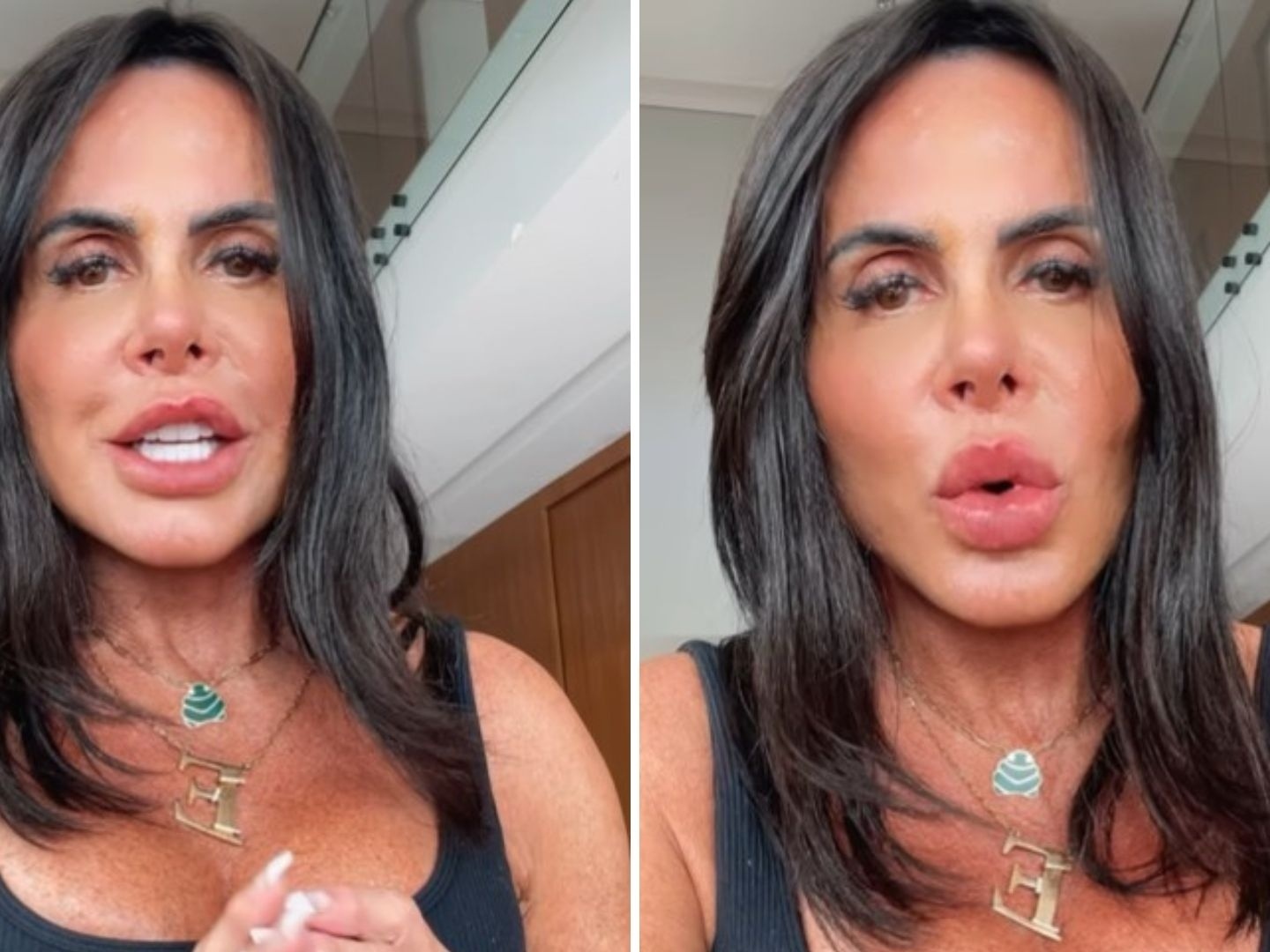 Gretchen celebra novo rosto após procedimento