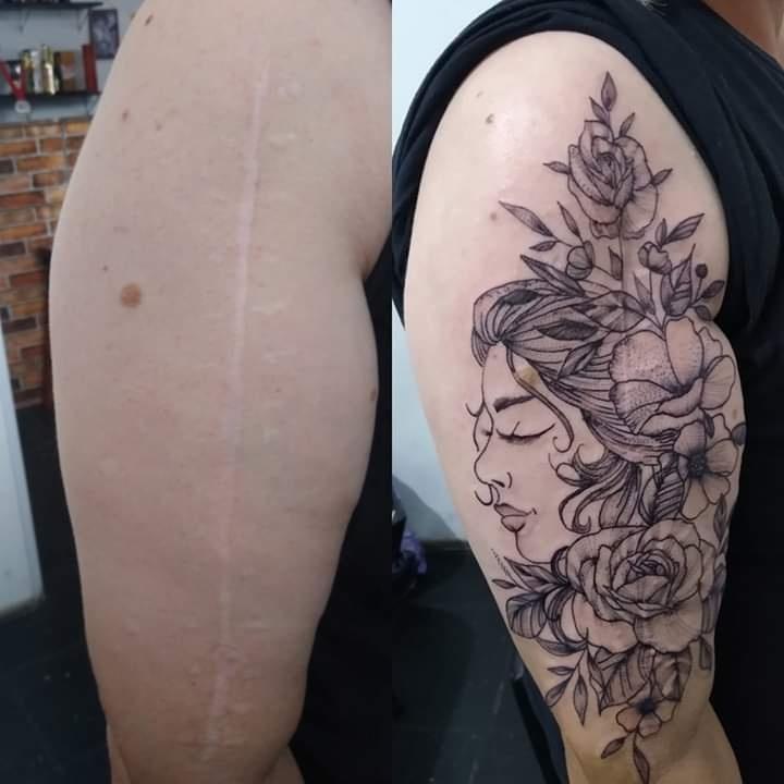 Ela Faz Tatuagem Gratuita Sobre Cicatrizes De Mulheres Vitimas De Violencia 14 03 2020 Uol Universa