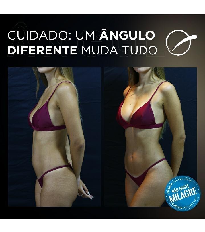 Cirurgia plastica  +92 anúncios na OLX Brasil