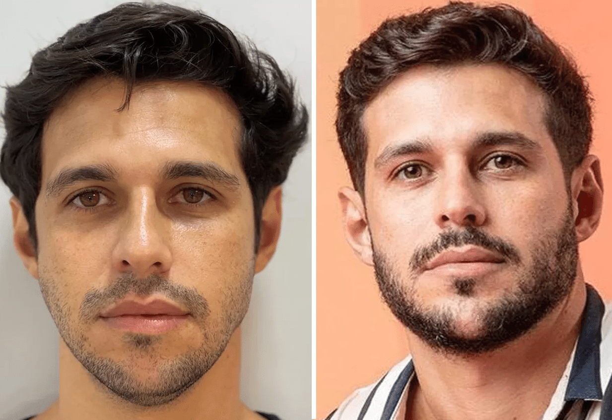 Qual é a doença de Rodrigo Mussi?
