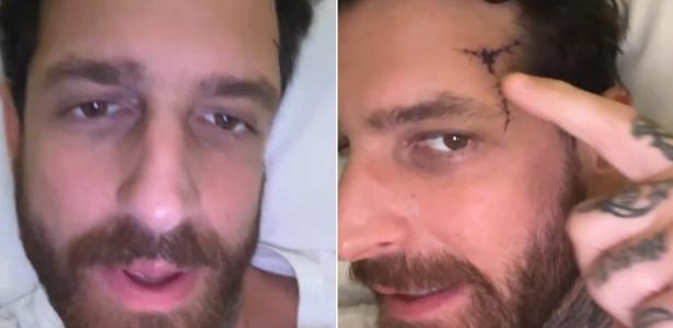 Leandro D Lucca marido de Cleo sofre traumatismo craniano após queda