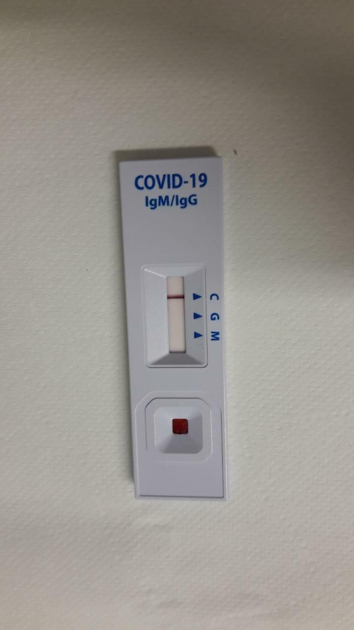 15% dos testes rápidos dão positivo para covid-19 no Brasil - TecMundo