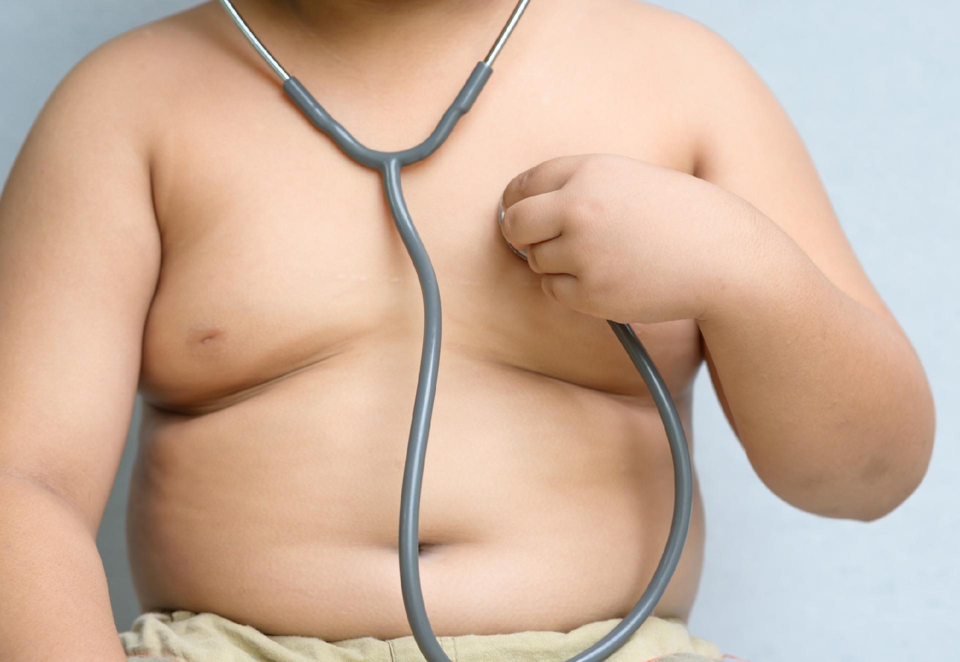 Obesidade infantil: quais os melhores exercícios para combater?