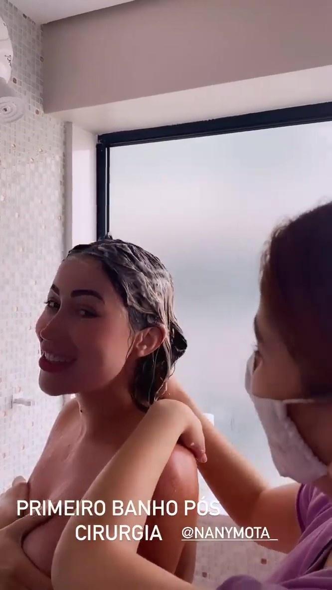 Carol Narizinho mostra primeiro banho após lipo: Delícia