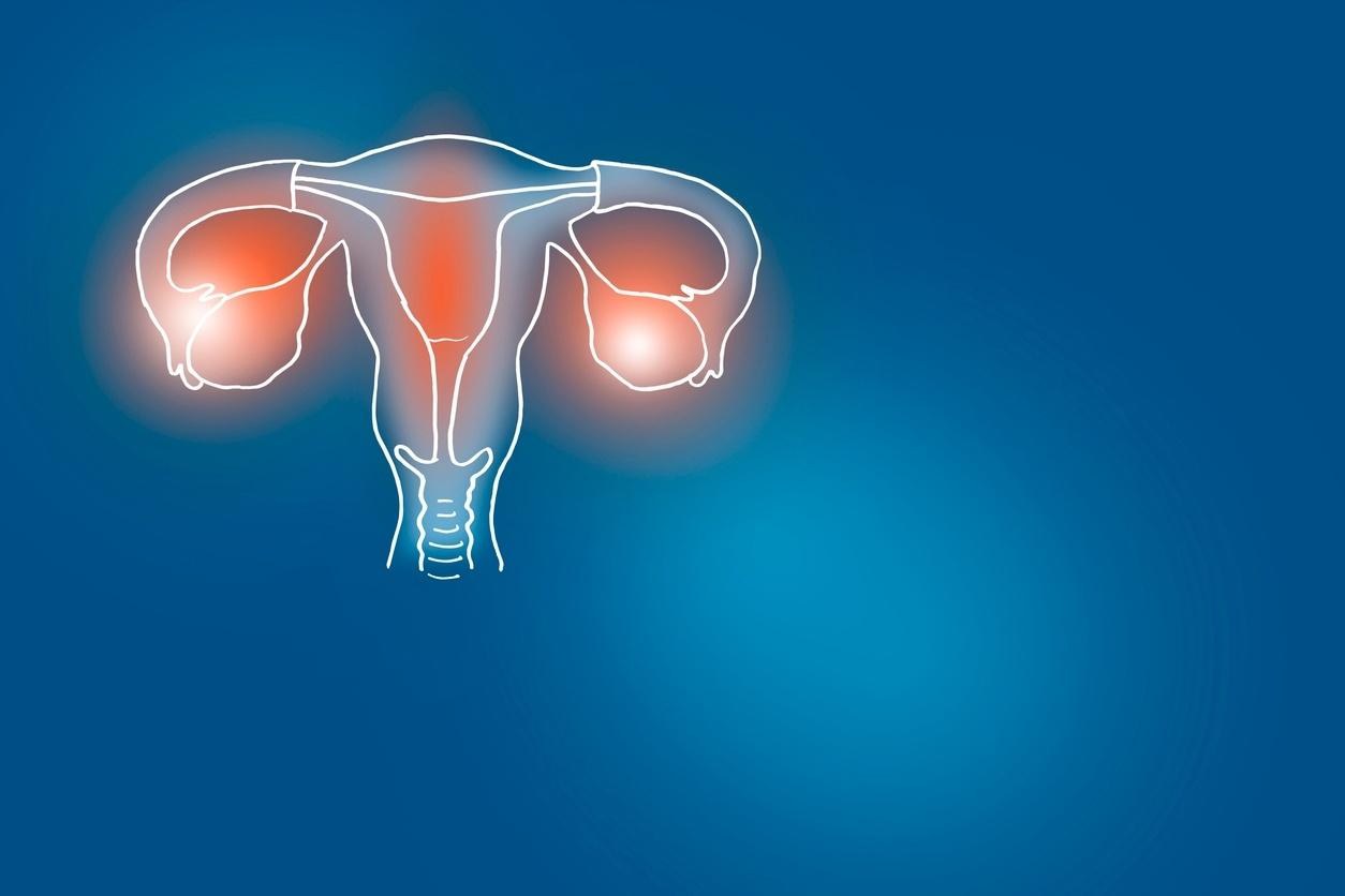 O uso da laparoscopia para a realização das cirurgias de retirada dos focos  visíveis da endometriose tem se mostrado superior à técnica abdominal, By Dr. Yulo Césare
