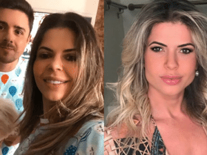 Ex BBB Cacau Colucci Faz Procedimentos Em Nariz E Maxilar Veja Como