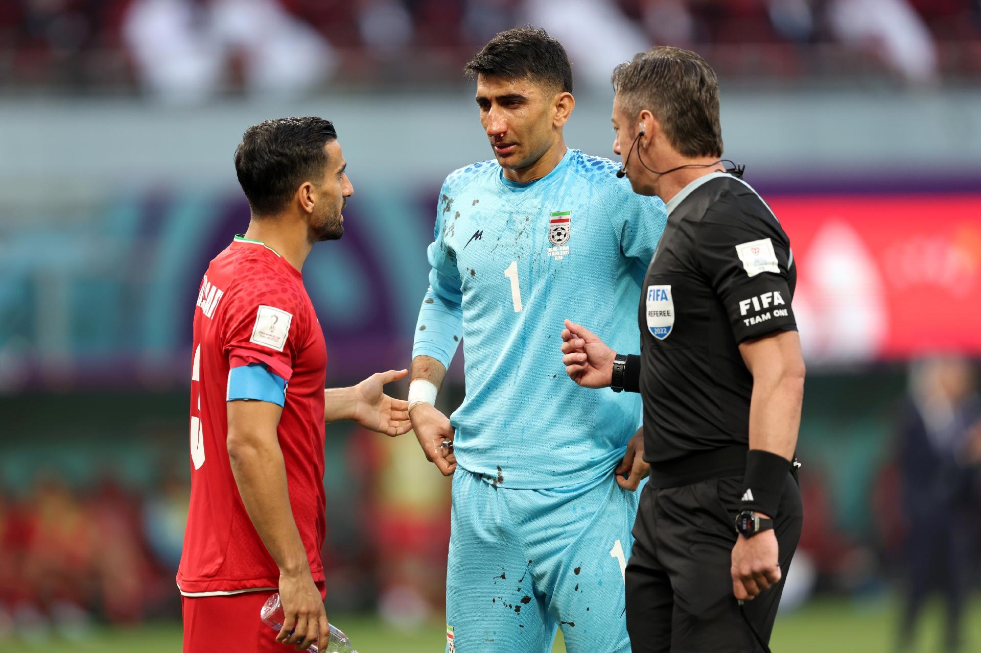 Técnico do Irã confirma concussão do goleiro, que não joga contra