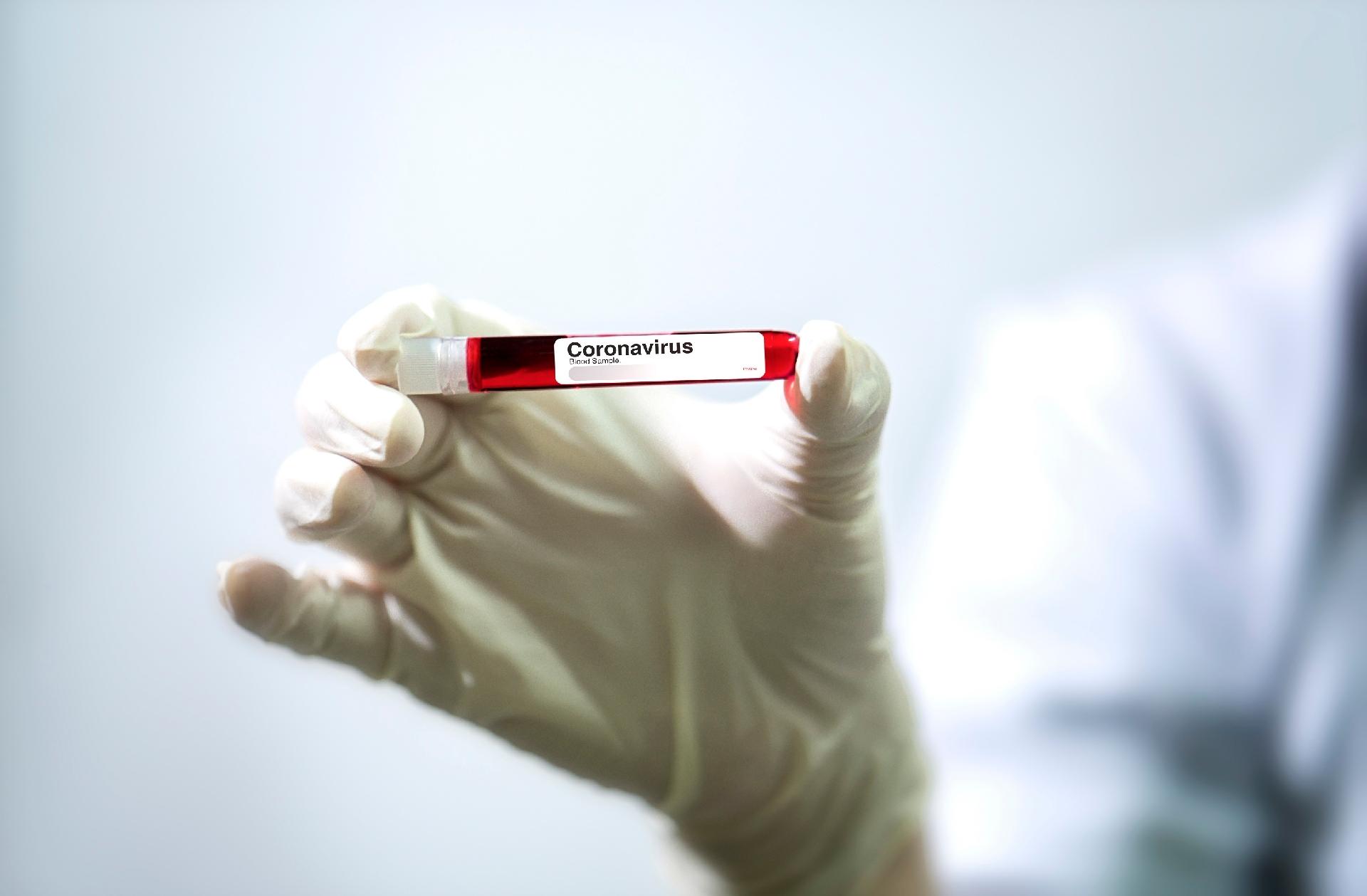 Cientistas vão testar vacina contra Fentanil em humanos