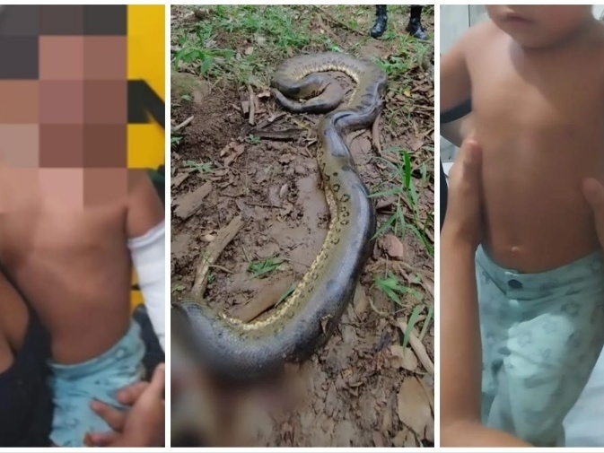 Bebê de um ano é atacada por cobra dentro de casa no litoral de SP