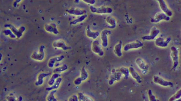 Ameba Naegleria fowleri, conhecida como 'ameba comedora de cérebros' Ameba Naegleria fowleri, conhecida como 'ameba comedora de cérebros'