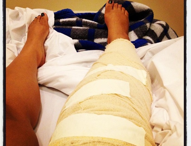 Preta Gil mostra foto da perna enfaixada após passar por cirurgia no joelho. "Foi tudo bem, Deus guiou a cirurgia", escreveu a cantora que operou uma lesão no menisco (16/4/12)