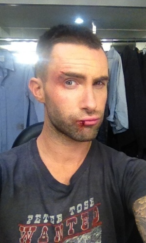 Adam Levine, vocalista do Maroon 5, posta foto com o lábio machucado no Twitter. O cantor explicou que os ferimentos são de mentira e foram feitos para a gravação do clipe da música "Payphone" (20/4/12)
