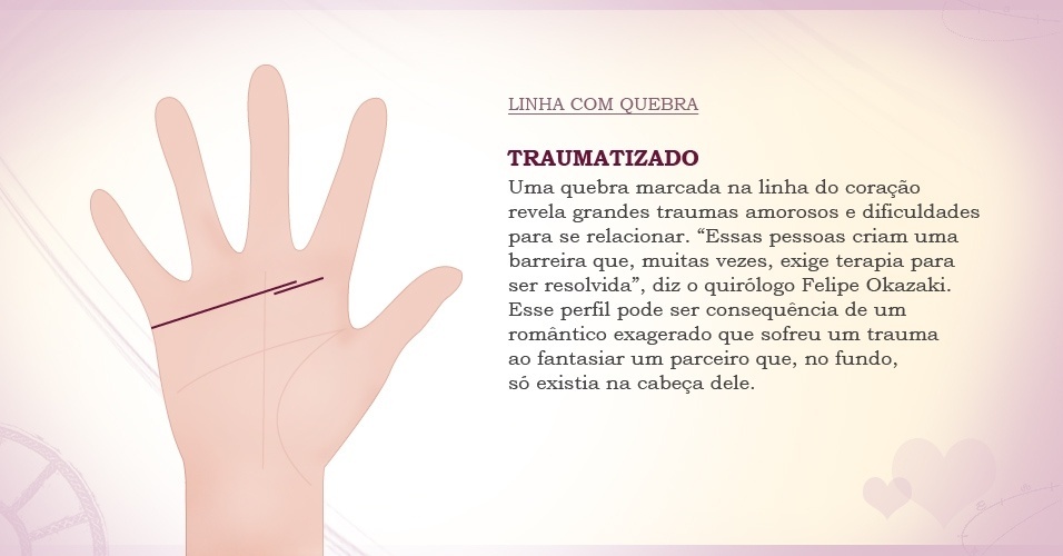 linhas das mãos, traumatizado, foto 4 - Arte/UOL