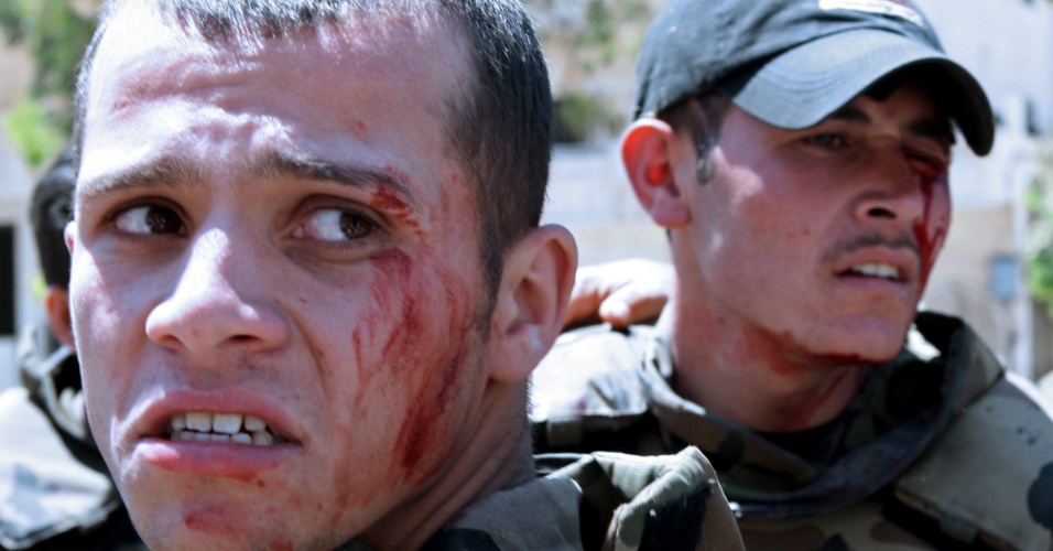 9.mai.2012 - 9.mai.2012 - Soldados ficam feridos após a explosão de uma bomba atingir o veículo em que eles estavam, durante a escolta ao comboio dos enviados da ONU à Síria. Pelo menos seis soldados ficaram feridos
