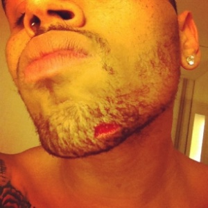 O cantor Chris Brown publicou em seu perfil no Instagram  uma foto em que aparece com um corte no queixo (13/6/12) - Reprodução/Instagram