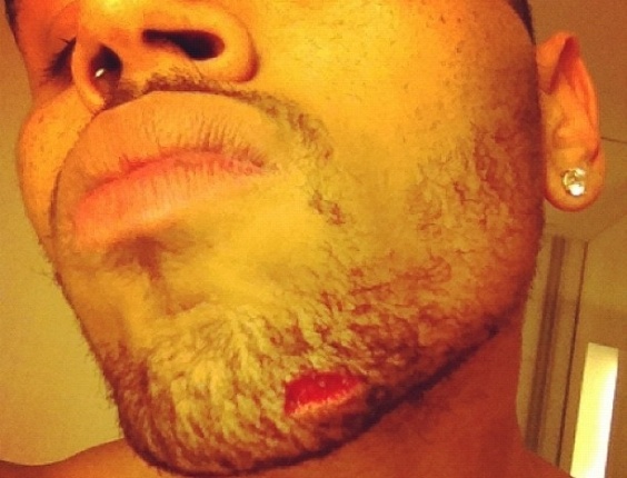 O cantor Chris Brown publicou em seu perfil no Instagram uma foto em que aparece com um corte no queixo (13/6/12)