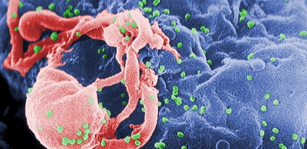 Célula infectada pelo HIV: nova pílula ajuda a interromper replicação do vírus - CDC