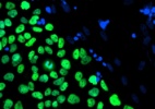 O que você sabe sobre células-tronco? - Marcelo Rivolta/Universidade de Sheffield
