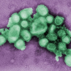 Vírus da gripe H1N1 - CDC