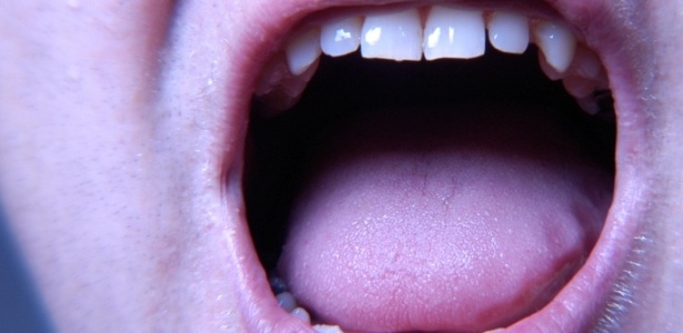O que a aparência da sua língua tem a dizer sobre sua saúde? - 15
