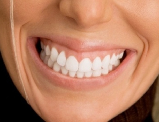 Hábitos que podem prejudicar os dentes - como escová-los 