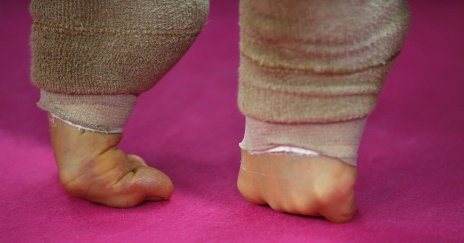 Imagem mostra em detalhes os pés da ginasta italiana Erika Fasana durante apresentação em Londres
