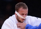 Judoca francês leva pancada e continua luta com proteção 