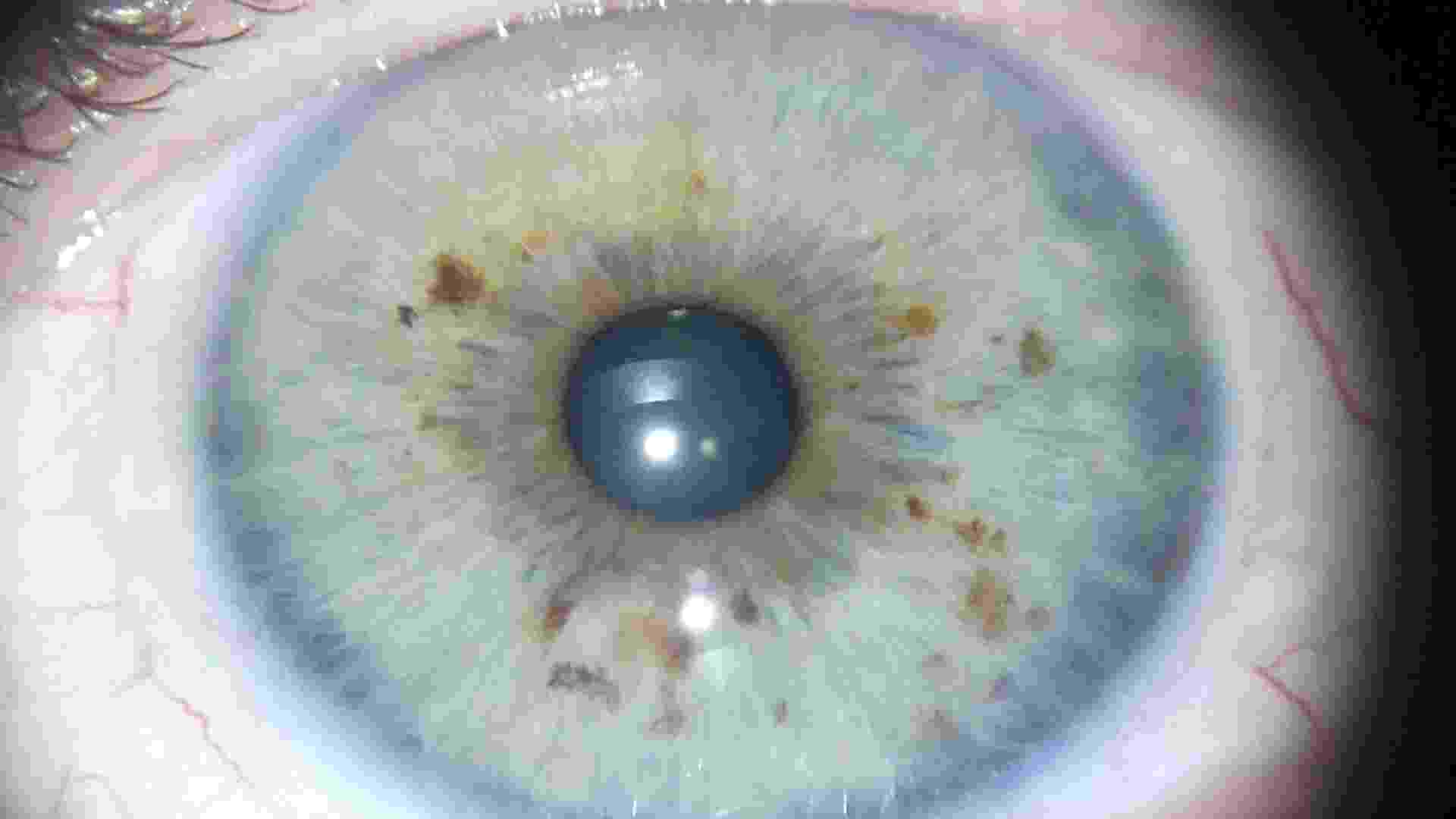 Fotos: Para a iridologia, as íris revelam as características emocionais ...