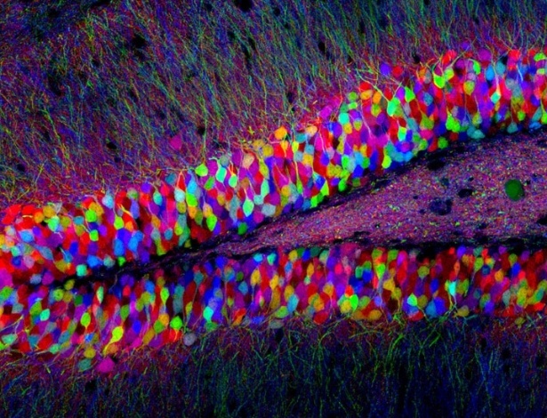 2.ago.2012 - O projeto é chamado de "Brainbows", uma mistura de cérebro com arco-íris, devido ao colorido das imagens