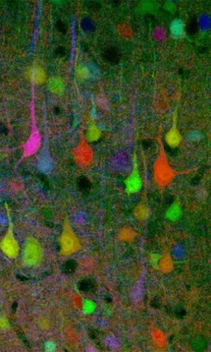 2.ago.2012 - Segundo os cientistas, a técnica pode ajudar a comunidade científica a descobrir mais sobre atividades cerebrais, além de auxiliar na investigação de doenças do sistema nervoso