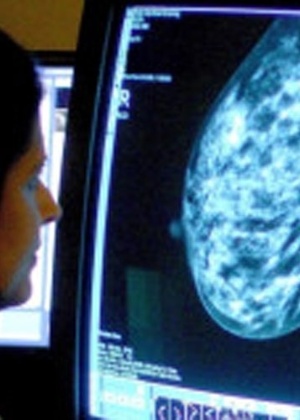 Pacientes com câncer de mama desenvolvem resistência à quimioterapia - PA