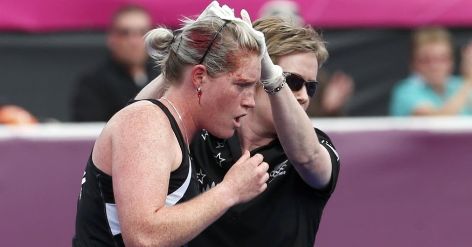 Katie Glynn, da Nova Zelândia, deixa o campo sangrando após ser atingida na cabeça na semifinal feminina do hóquei na grama contra a Holanda