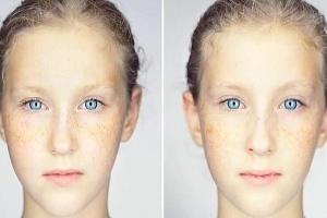 Imagens de Martin Schoeller registram gêmeos com mesma expressão - BBC