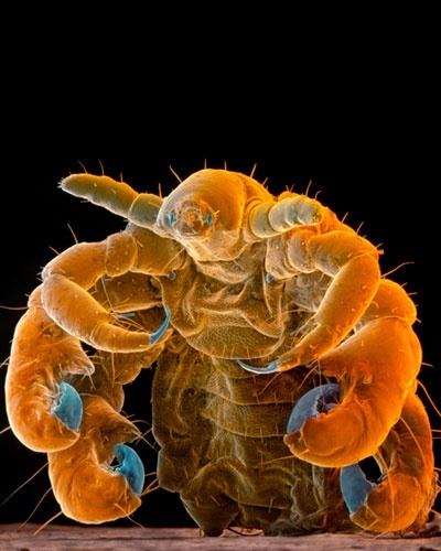30.ago.2012 - O piolho-caranguejo infesta os seres humanos e se alimenta exclusivamente de sangue. Também é conhecido por piolho-da-púbis, por conta da região em que costuma se hospedar