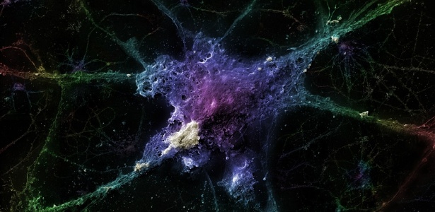 Neurônio sob o efeito da proteína beta-amiloide, que gera as chamadas placas de senilidade, que, acredita-se, seriam as principais causas do Alzheimer - Linnea Rundgren/BBC