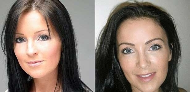 A britânica Claire Culverwell antes (à esq.) e depois da cirurgia de implante de sobrancelha - BBC
