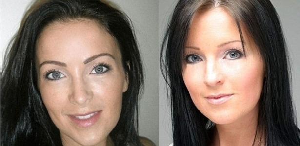 Na esquerda, Claire Culverwell após a cirurgia de transplante de pelos. Na direita, a mulher antes do procedimento - BBC