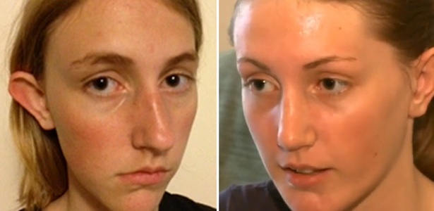 Em entrevista à BBC Brasil, cirurgião plástico justificou operação devido às 'deformidades faciais' de Nadia