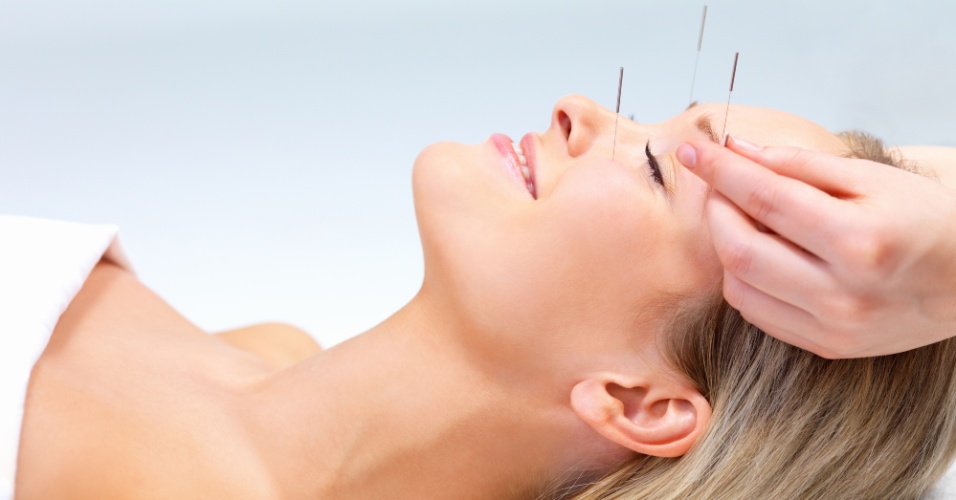 Mulher recebendo sessão de acupuntura facial