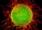 Quais são os tipos de células? - Divulgação/ Nikon Small World Photomicrography Competition