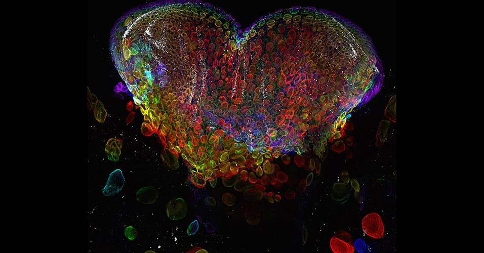 30.out.2012 - O olho de uma mosca da fruta, captada por Michael John Bridge, do laboratório de imagens celulares da Universidade de Utah, conquistou o sétimo lugar
