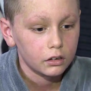 Reação alérgica a remédio à base de ibuprofeno levou o garoto de 11 anos a uma UTI de hospital - BBC