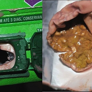 Polegar de perna de foto de fungo