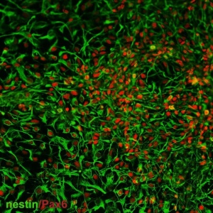 Células progenitoras neurais derivadas de urina humana - Lihui Wang, Guangjin Pan e Duanqing Pei/Divulgação