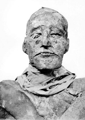Foto da múmia do faraó egípcio Ramsés 3º - BMJ via BBC