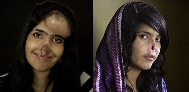 A afegã Aesha Mohammadzai hoje em dia e em 2010, quando foi fotografada pela revista Time - Reprodução