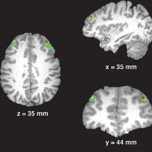 Córtex pré-frontal é responsável por atualizar lista de metas do cérebro - Jonathan Cohen/Divulgação