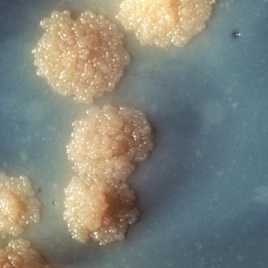 Imagem mostra cultura de bacilos causadores da tuberculose; cresce o número de relatos sobre resistência a antibióticos nas cepas da doença - CDC